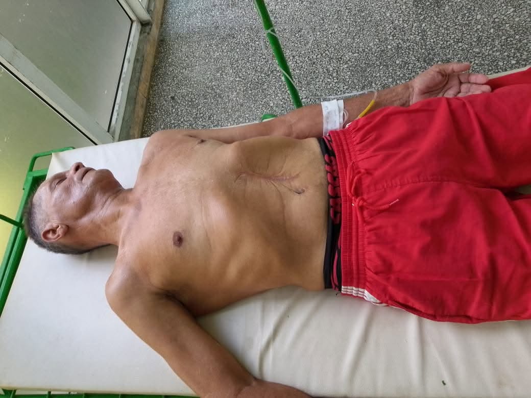 Del Sol inició su huelga de hambre en junio para reclamar la liberación del preso político del 11J Leonel Tristá y de otros 17 prisioneros políticos