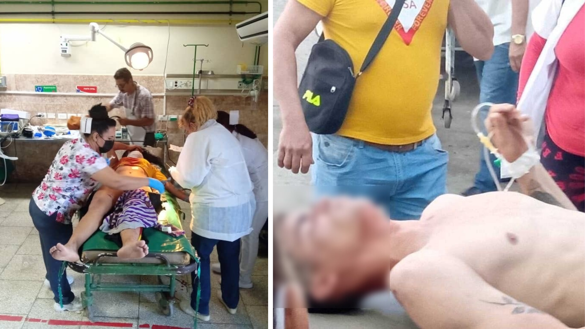 Accidente masivo en Matanzas: 6 niños entre los 27 lesionados