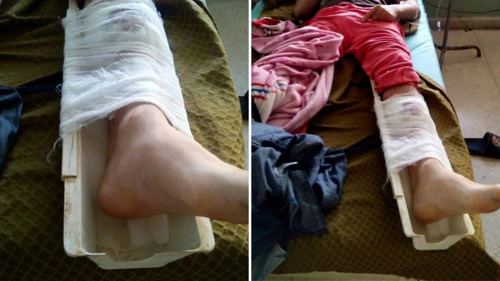 Activista cubano denuncia que le inmovilizaron la pierna con un pedazo de plástico