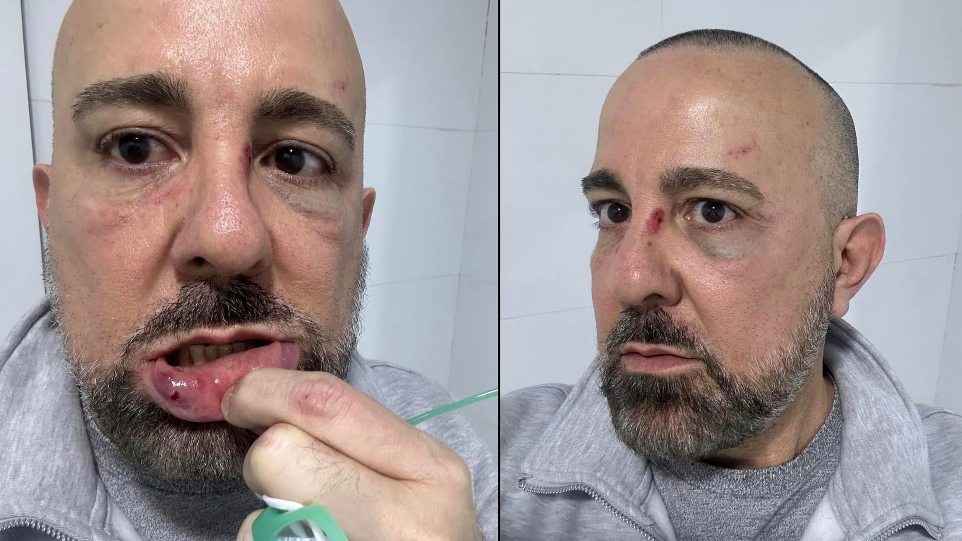 Adeptos del régimen cubano en Madrid agreden a activistas en concierto de Buena Fe