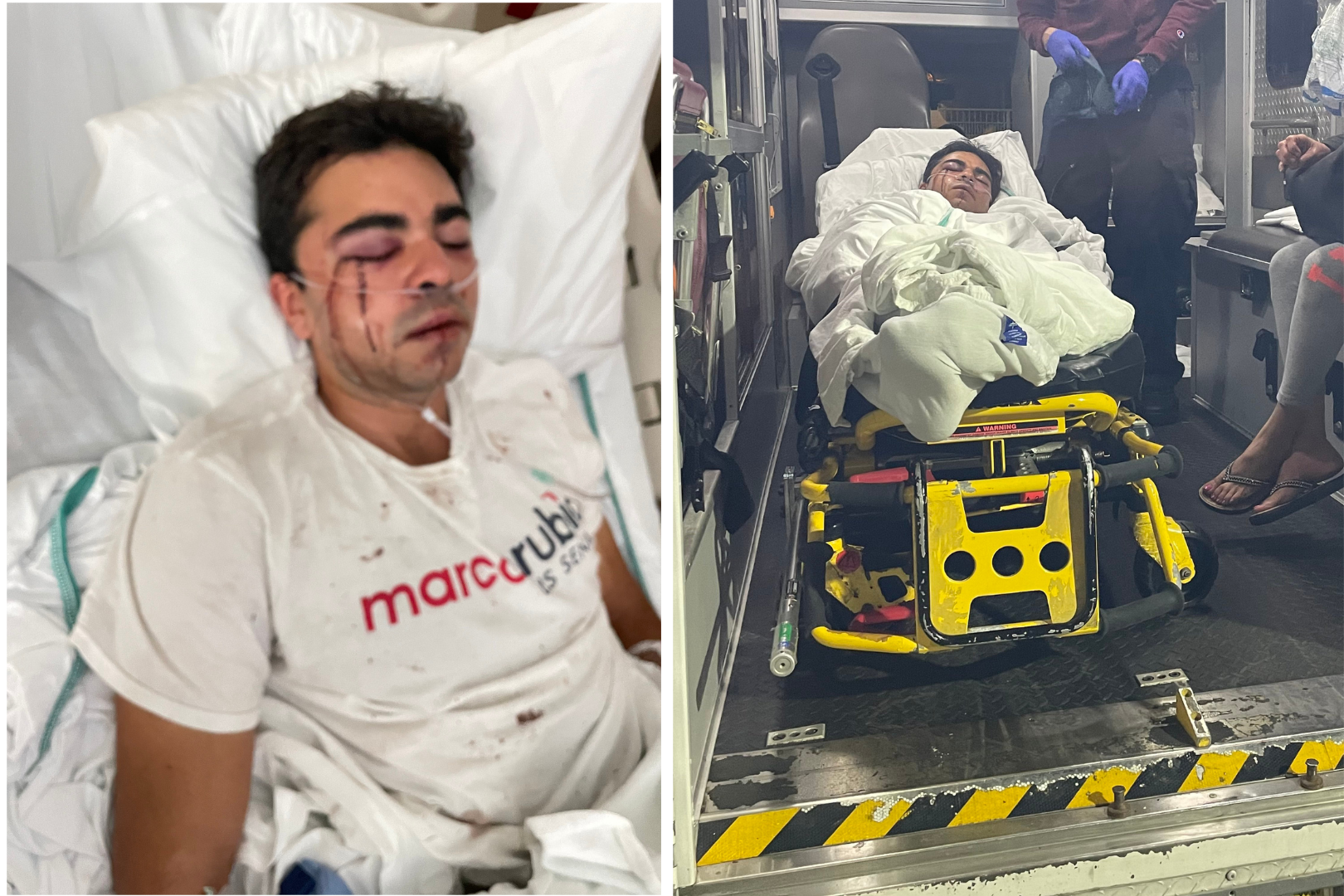 Agreden brutalmente a promotor de campaña del senador Rubio en Florida