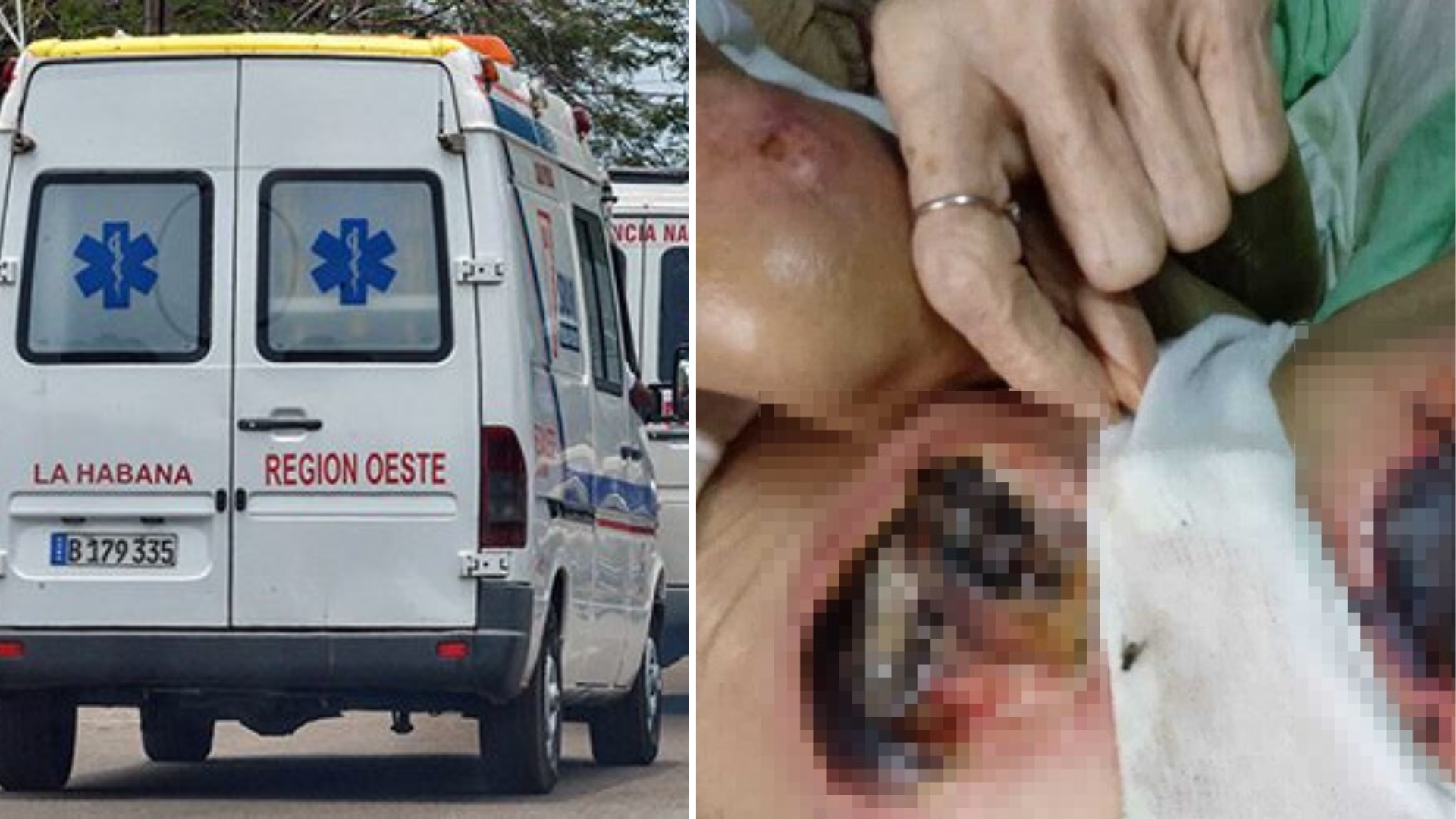 Anciana cubana con graves lesiones y anemia esperó 3 días por una ambulancia
