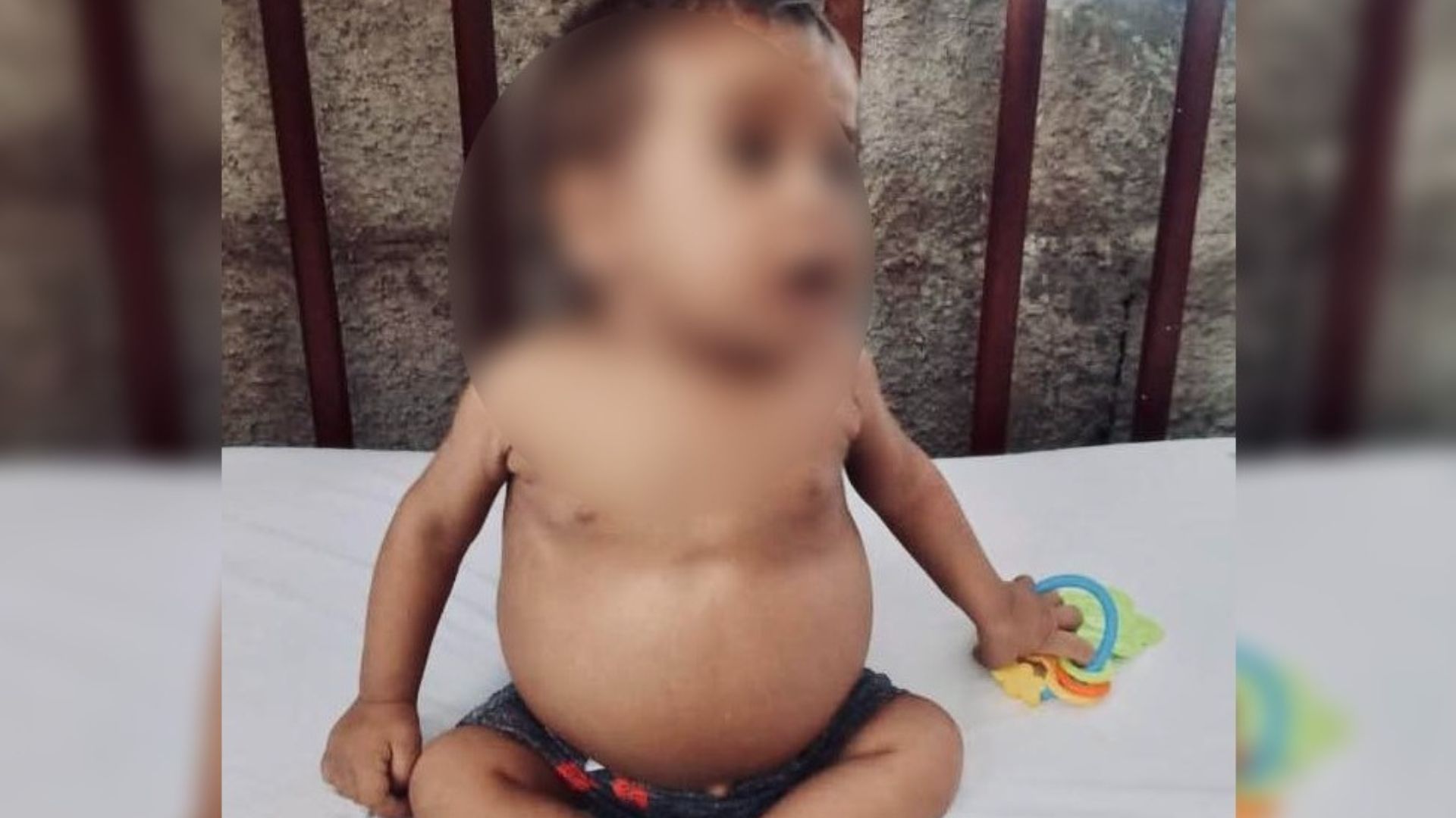 Bebé de 8 meses requiere trasplante de hígado y en Cuba no se realiza la cirugía