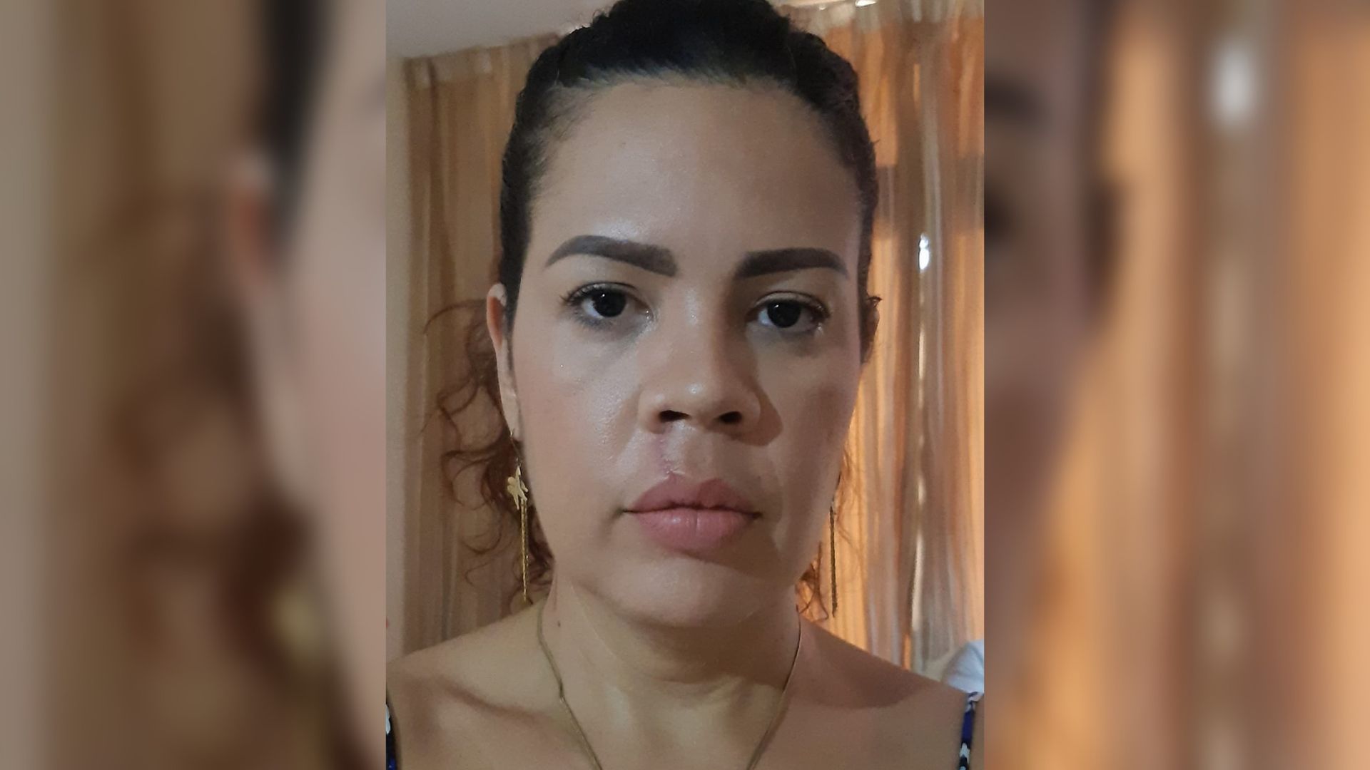 Cantante de la Original de Manzanillo vuelve al escenario tras agresión