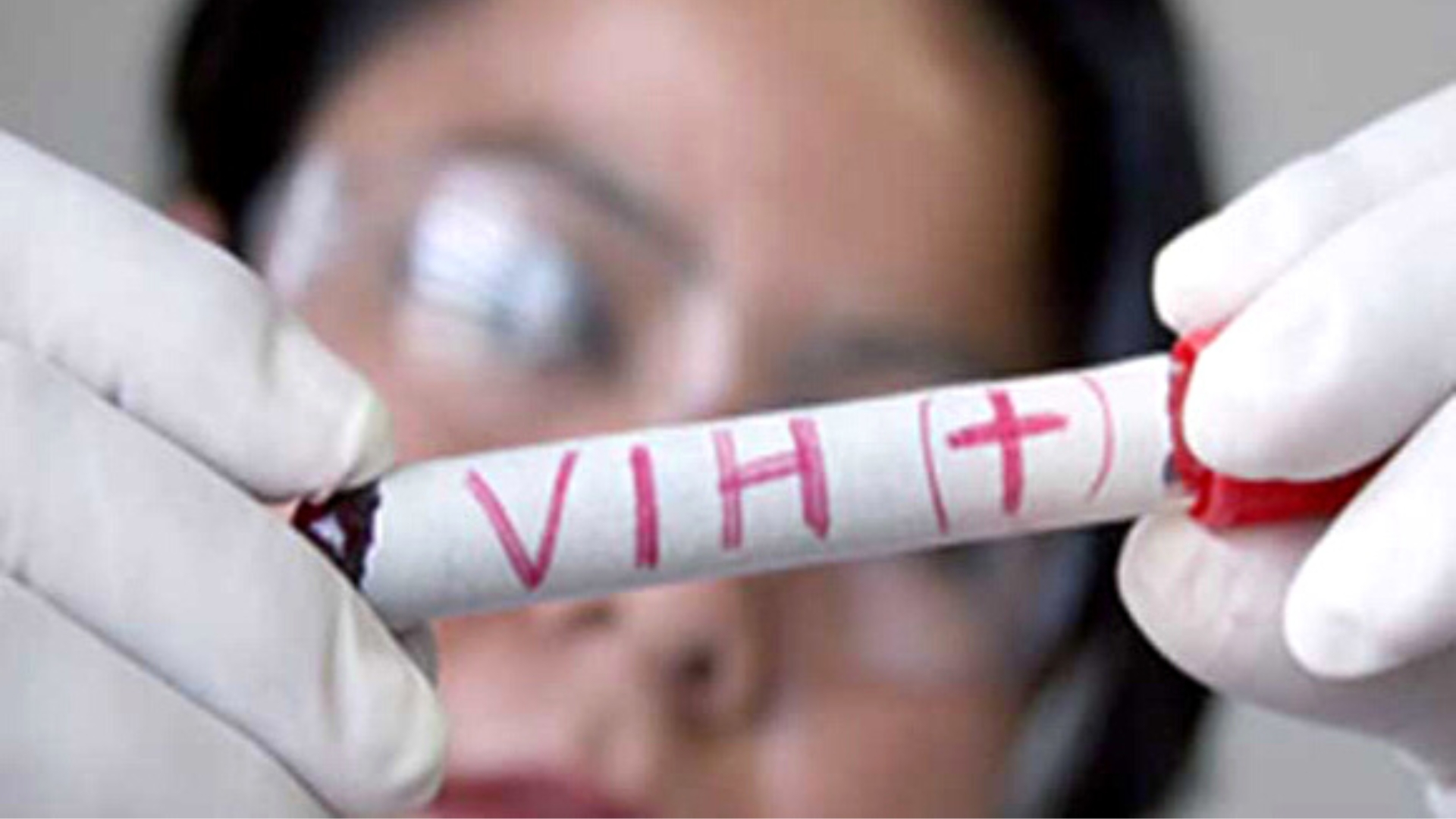 Cuba: 1500 personas contagiadas de VIH al año