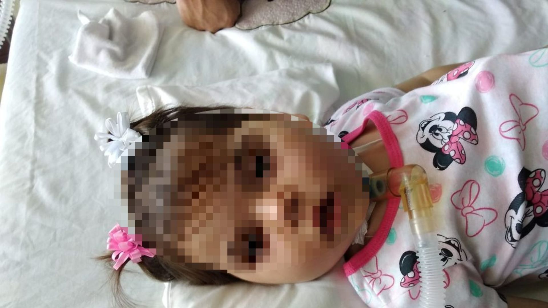 Cuba: Muere niña conocida como "La Bella Durmiente" 