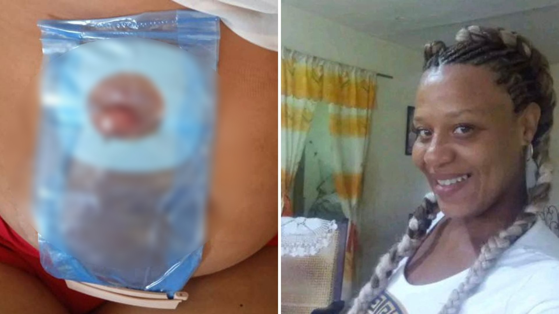 Cubana con cáncer uterino pide ayuda para conseguir tratamiento fuera de la isla
