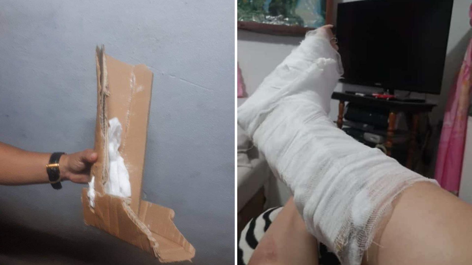 Cubana denuncia que le pusieron un pedazo de cartón tras fracturarse un pie