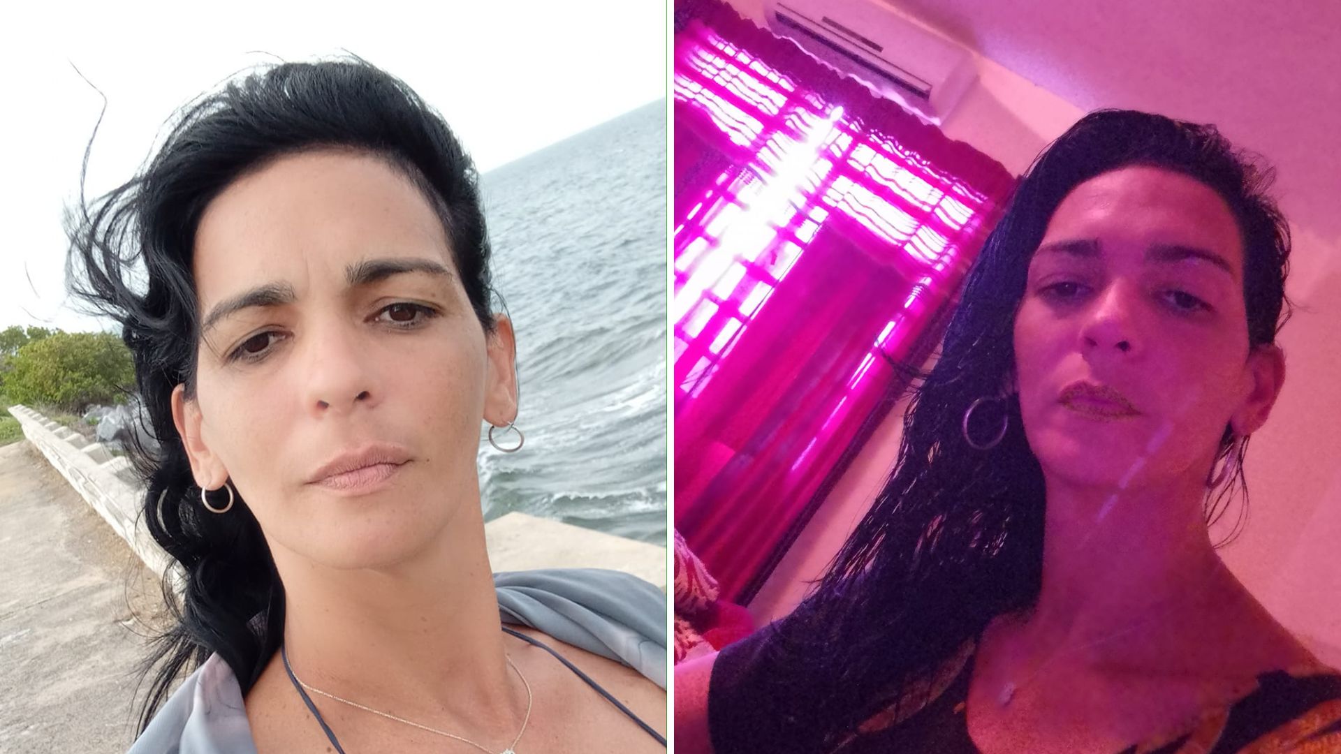 Cubana pide ayuda para conseguir un marcapasos: "No tengo mucho tiempo"