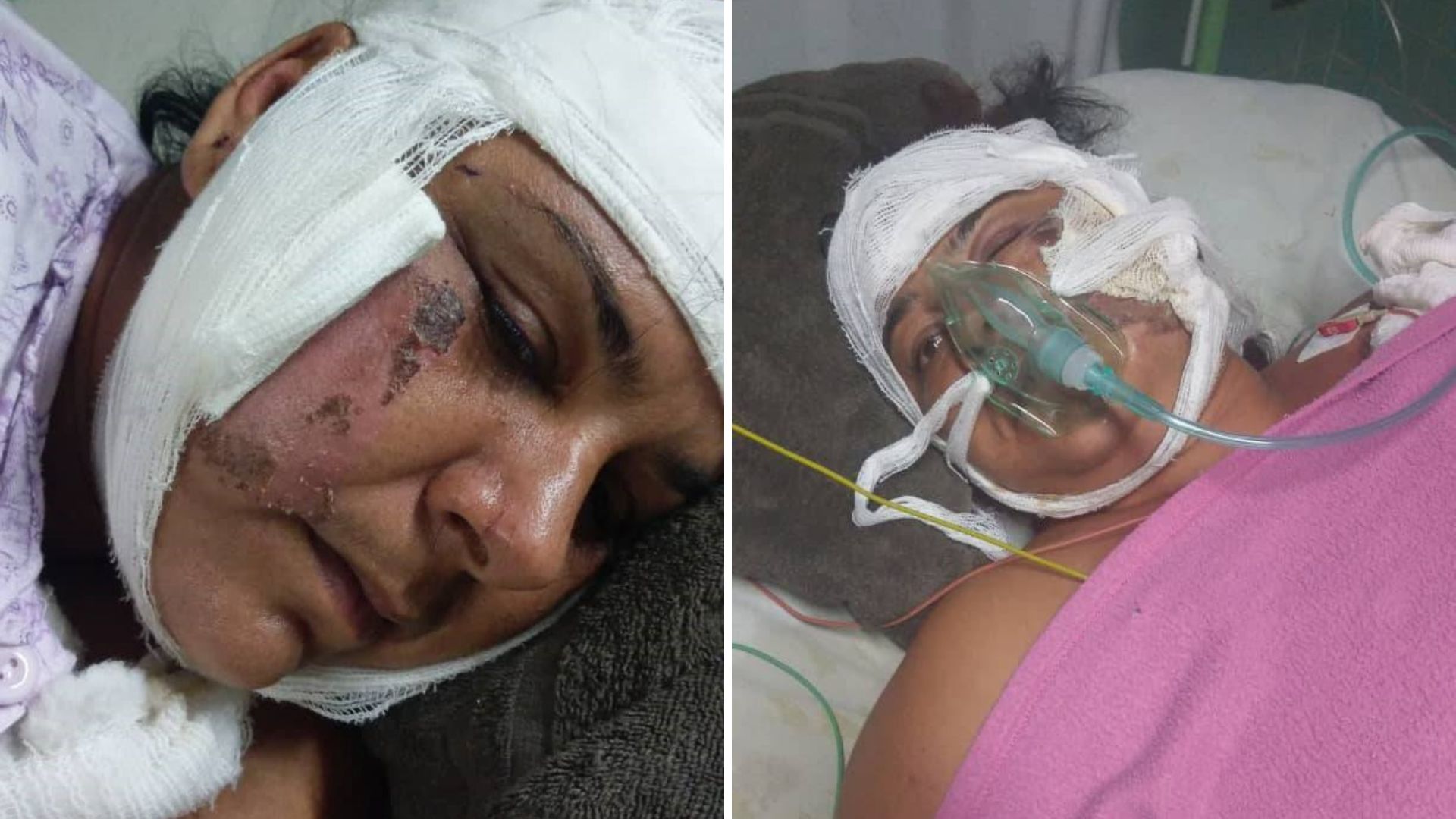 Cubana víctima de accidente denuncia que presunto culpable se fue del país