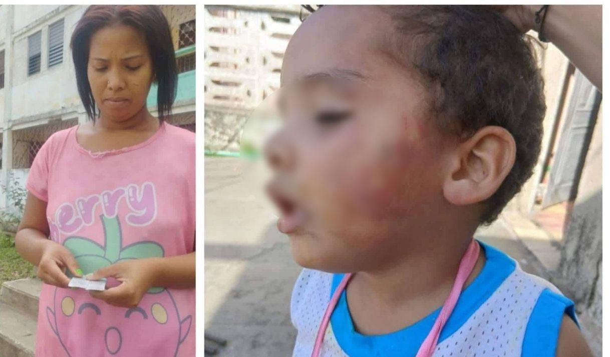 Denuncian brutal maltrato infantil contra un niño de 3 años en Sancti Spíritus