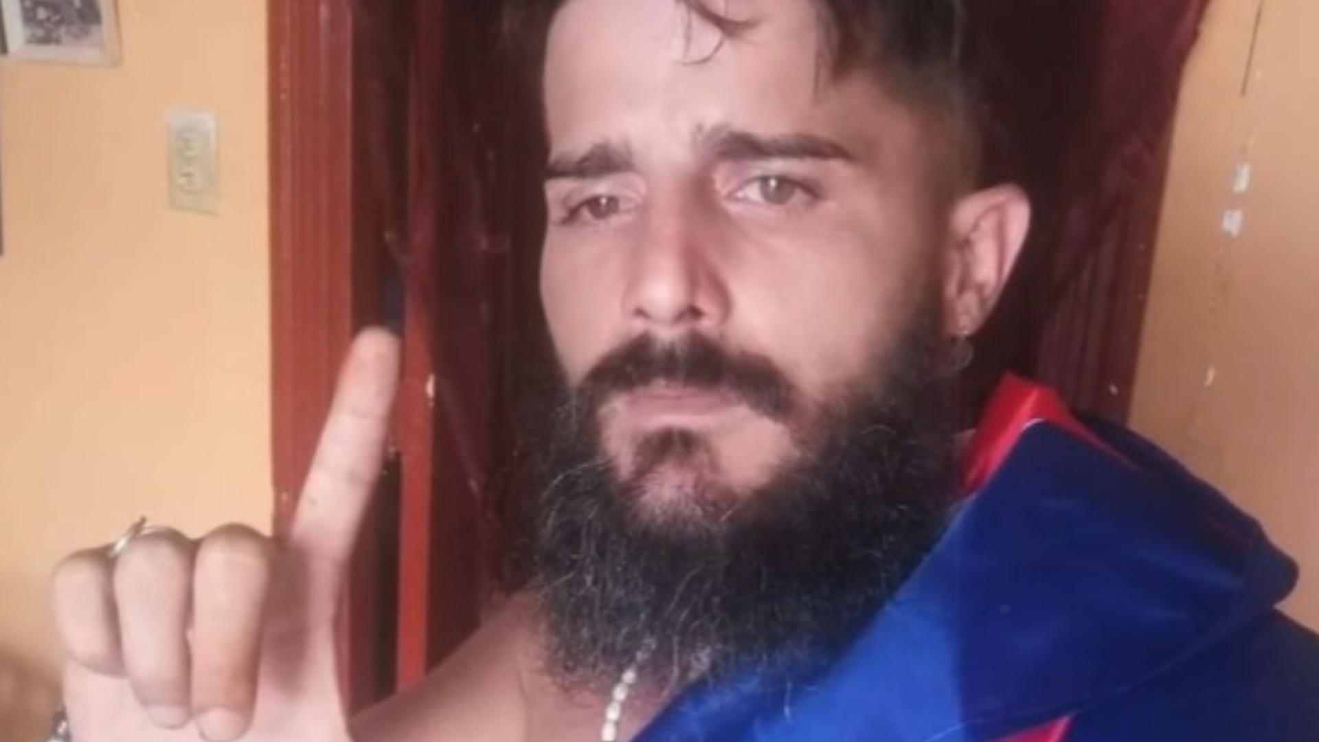 Denuncian que preso político Yasmani González Valdés se quedó sin dientes por falta de atención 