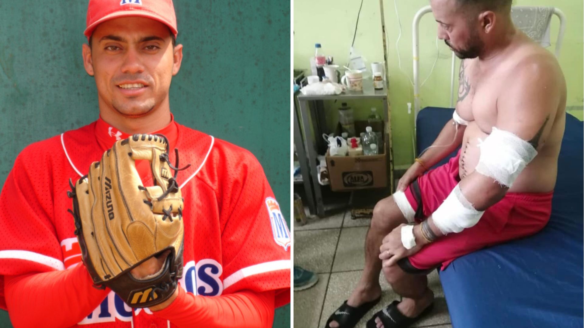 Hieren gravemente en asalto armado a expelotero de Series Nacionales
