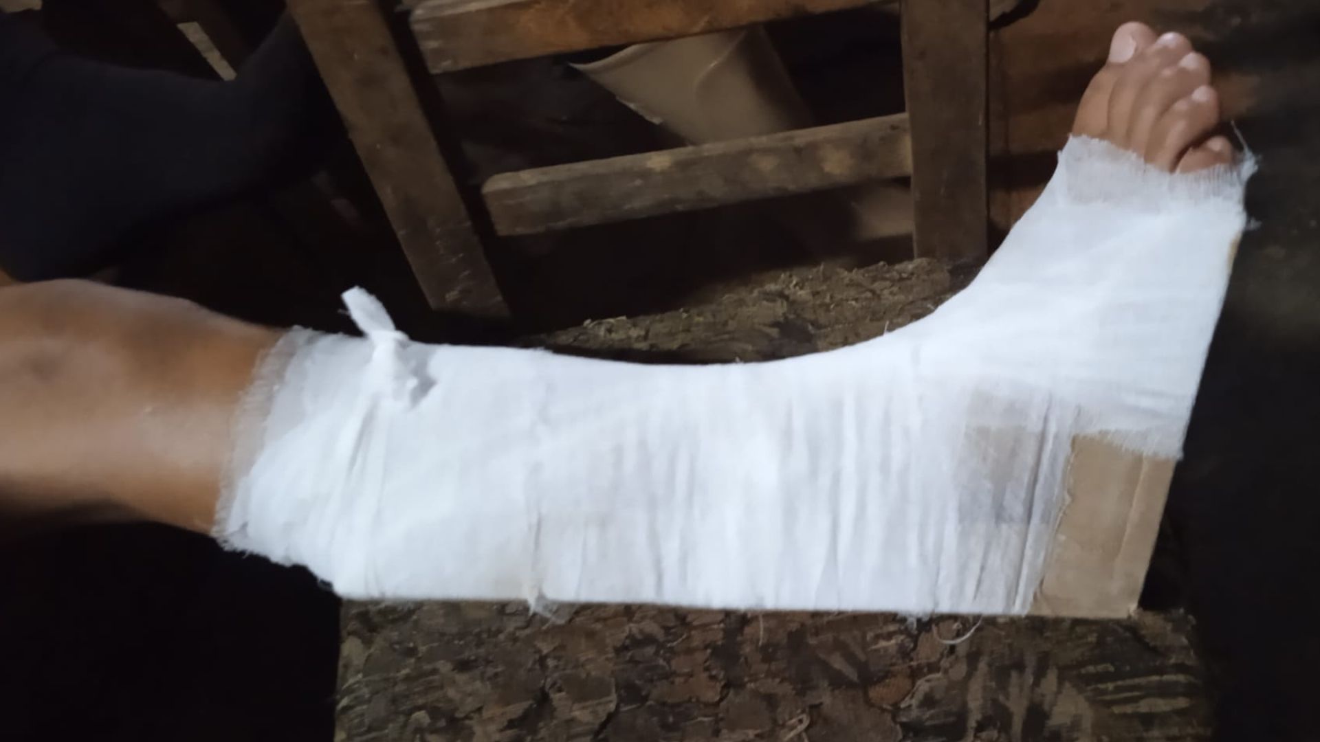 ¡Increíble! Utilizan caja de cartón para tratar esguince de un niño