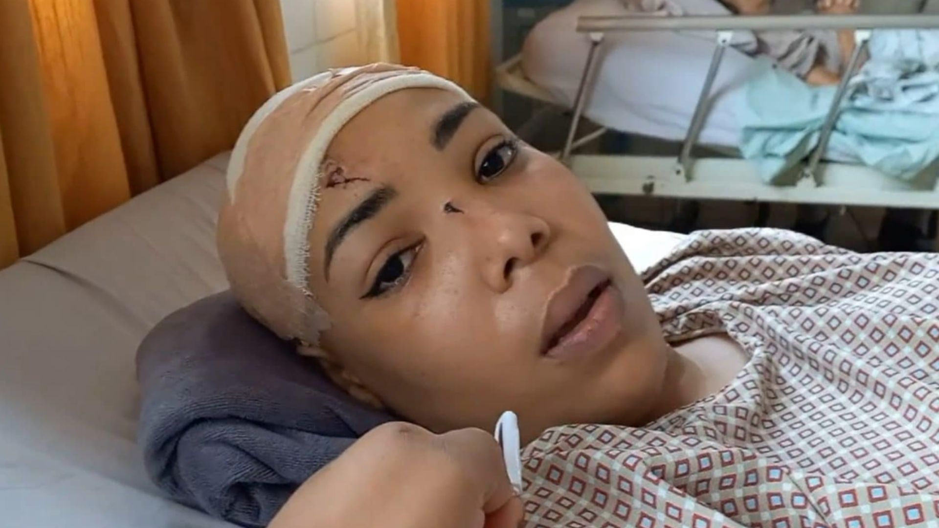 Intentan matar a martillazos a una cubana en Bolivia