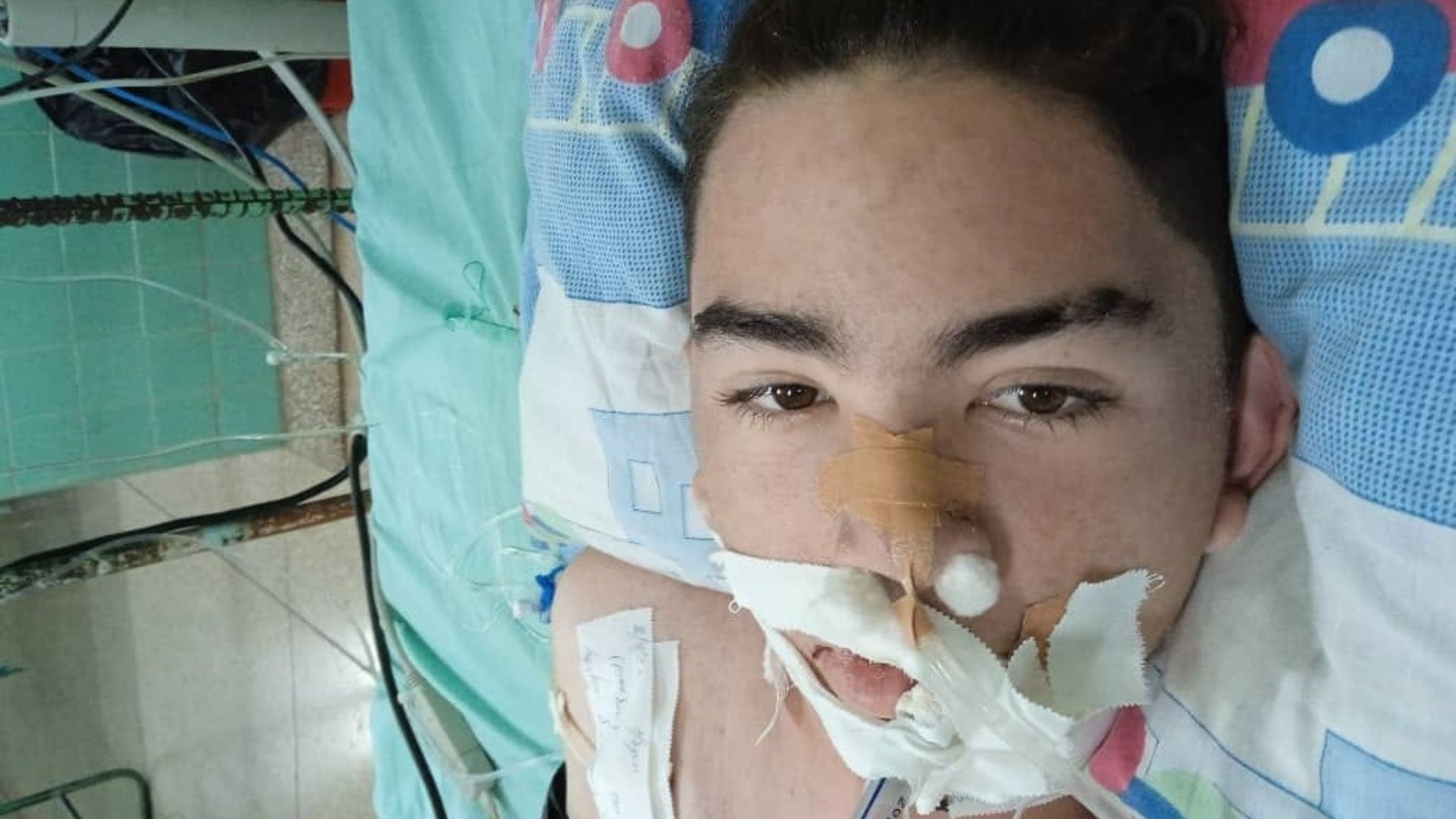Joven agredido con machete en Holguín continúa grave pero estable