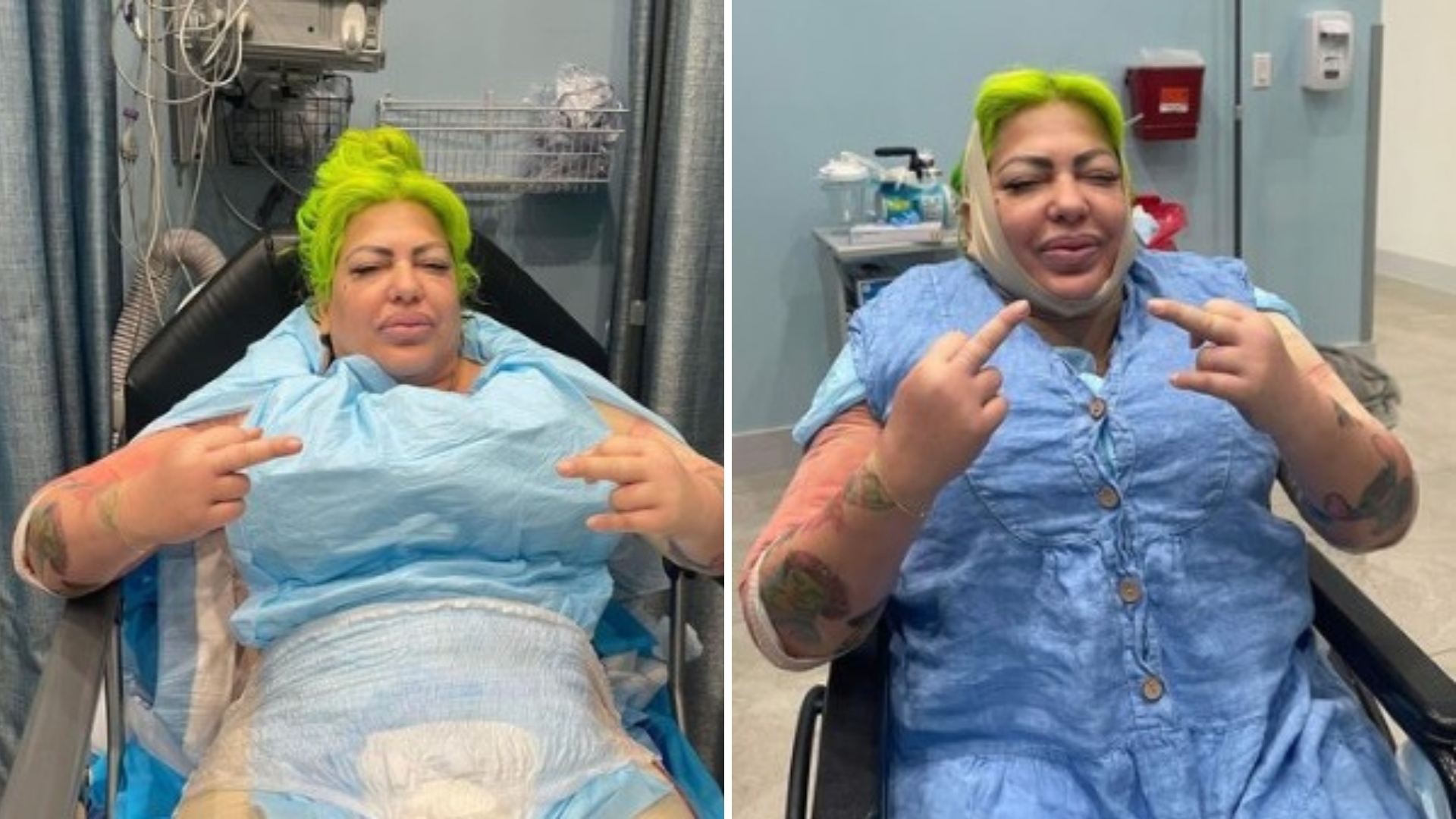 La Diosa se hace su primera cirugía estética en Miami