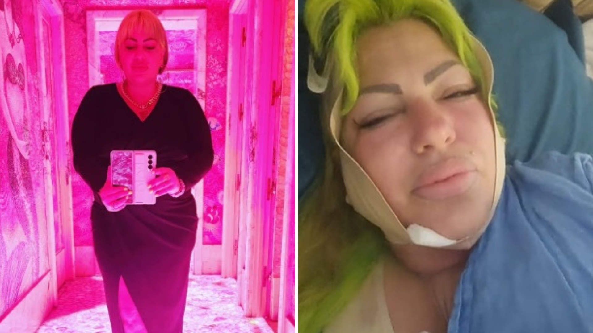 La Diosa tras cirugía estética: “Espero estar presentable en un mes”