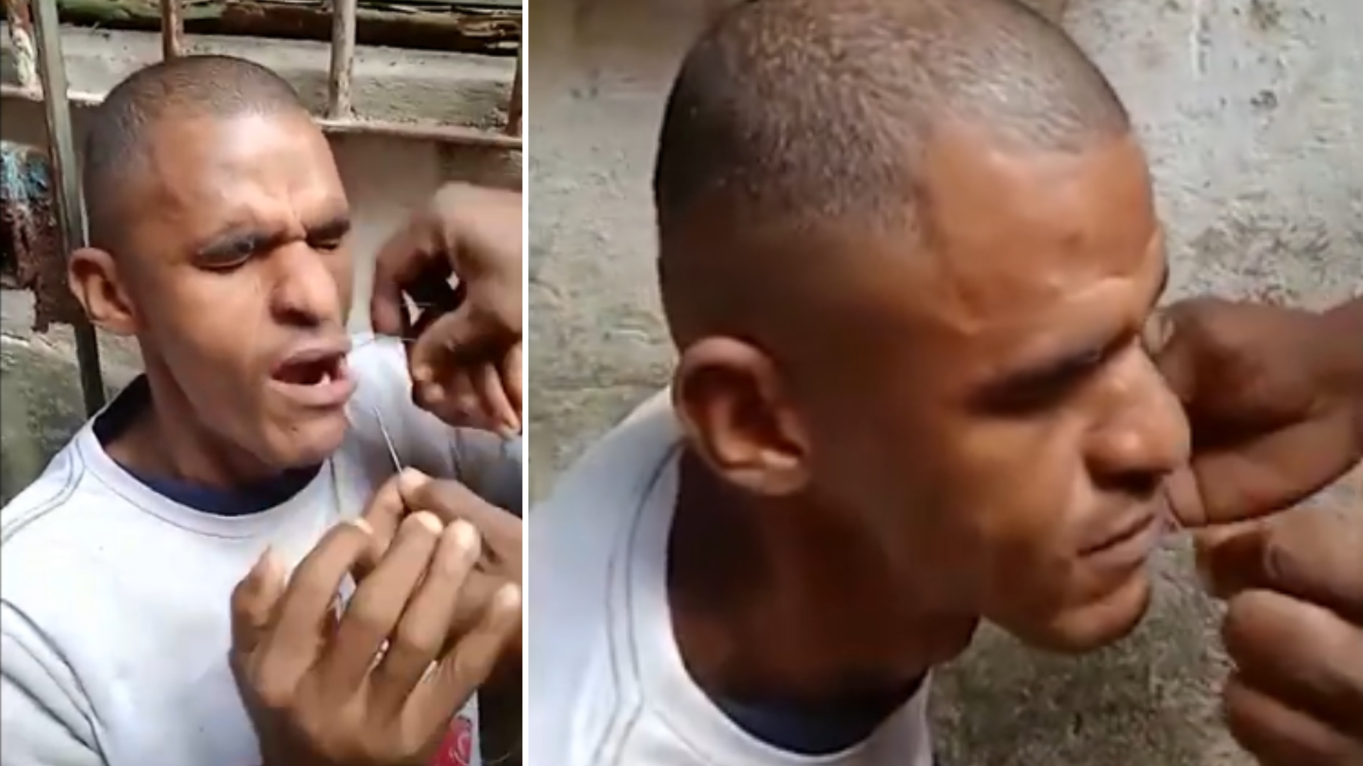 La Habana: opositor se cose la boca en San Isidro en protesta contra régimen cubano
