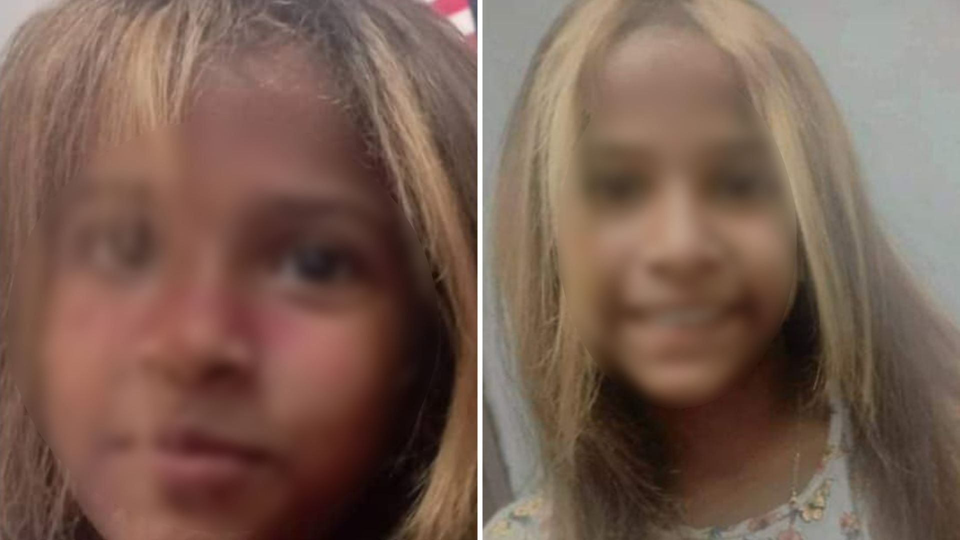 Madre pide ayuda para su hija que sufre desmayos sin diagnóstico en Cuba