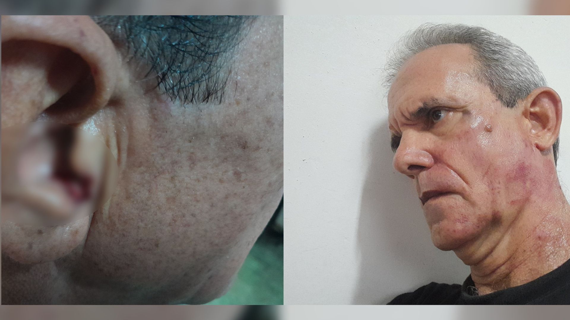 "Me dio con todo": teniente coronel del régimen golpea a escritor cubano