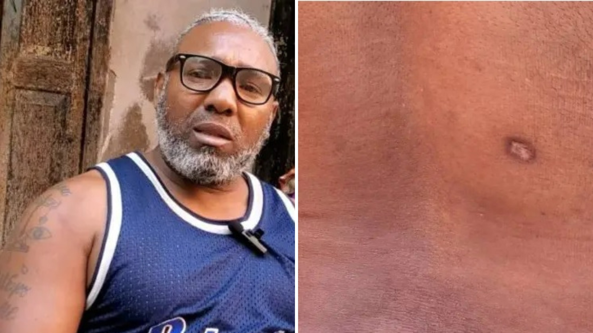 "Me tiraron tres disparos, el primero iba para la cabeza", asegura cubano baleado el 11J