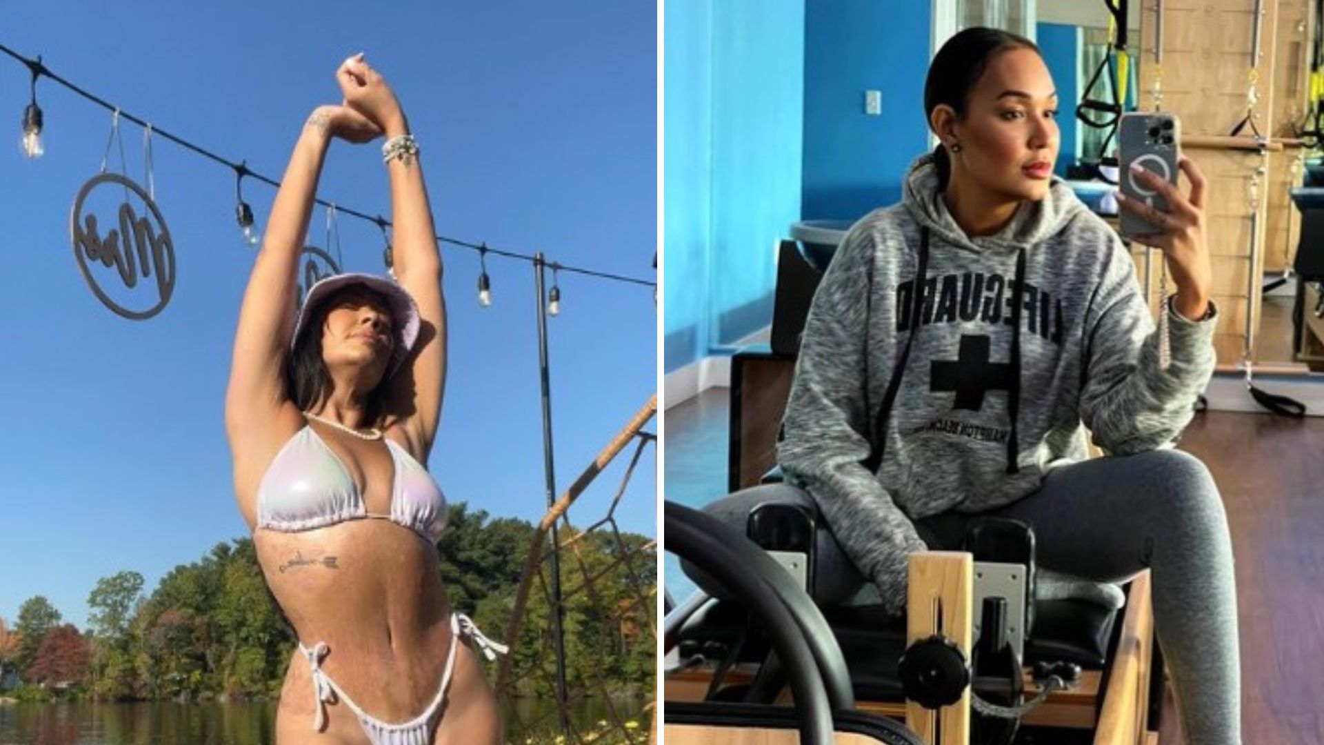 Muere a los 35 años influencer brasileña que se había realizado una cirugía para bajar de peso