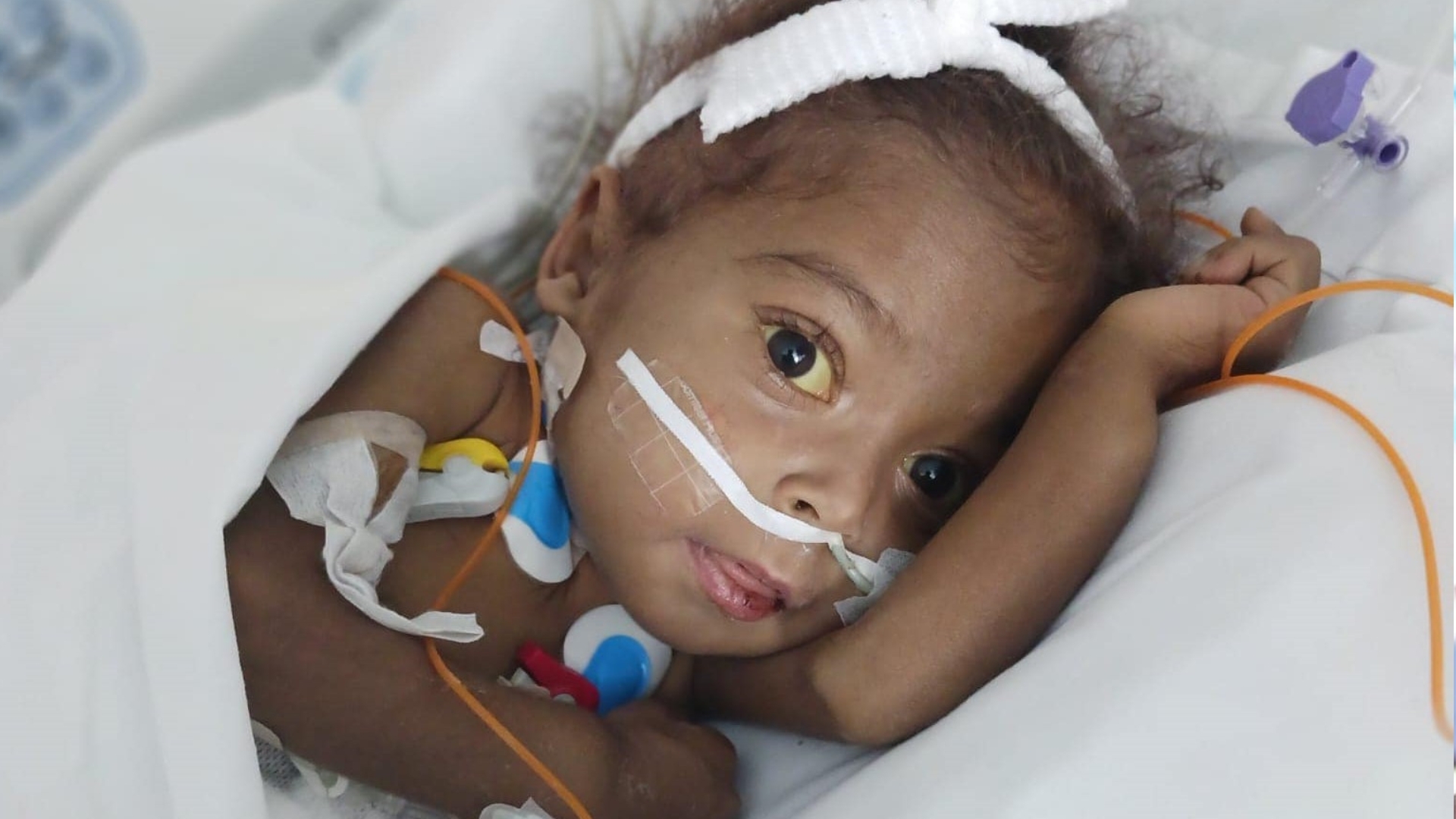 Niña Amanda se recupera en España: “Tiene todos sus parámetros bien”