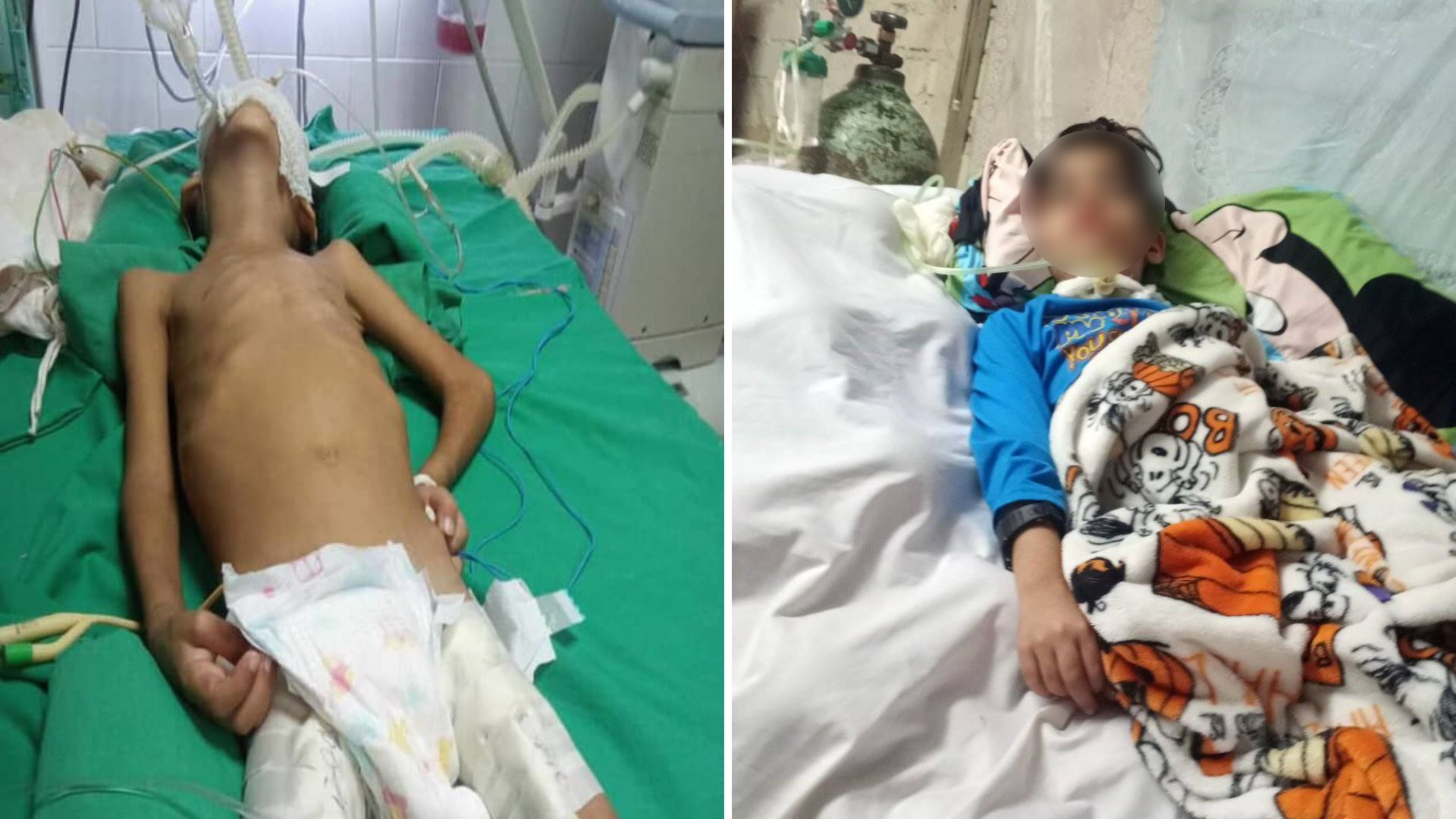 Niño cubano con VIH vive en pésimas condiciones: "Todo se inunda"