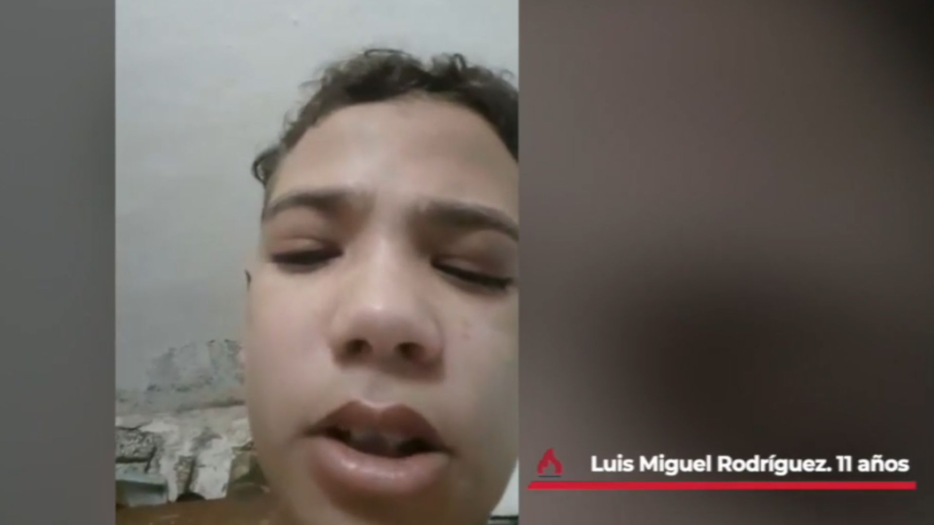 Niño cubano pide ayuda para un trasplante de córnea
