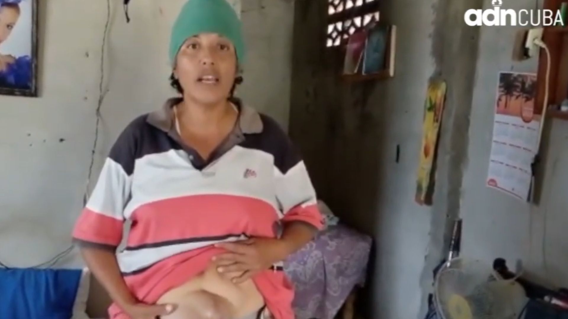 "No hay ningún tipo de recurso": cubana pide ayuda para operarse hernia