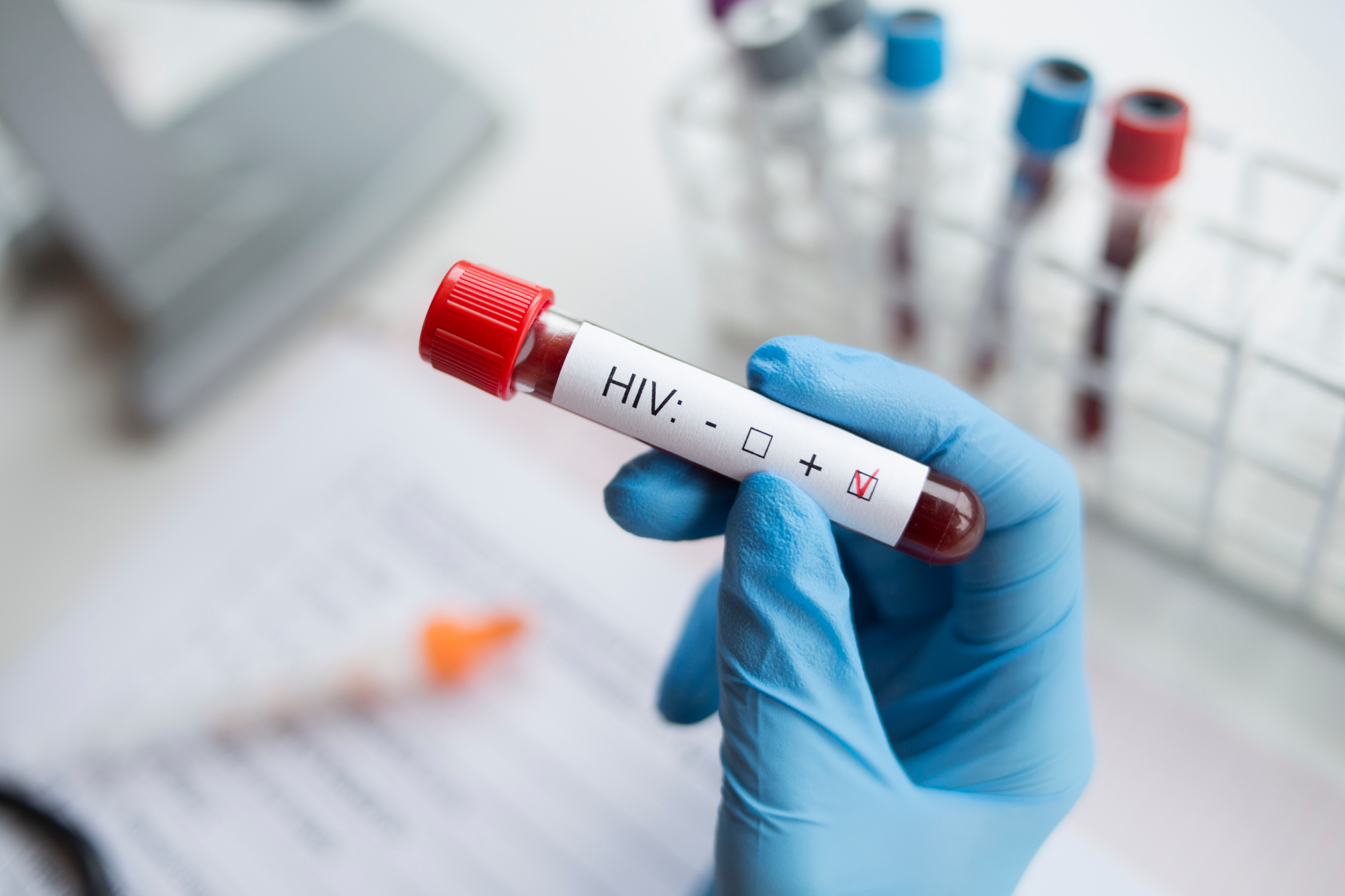 Nuevos avances en la investigación par una vacuna eficaz frente al VIH