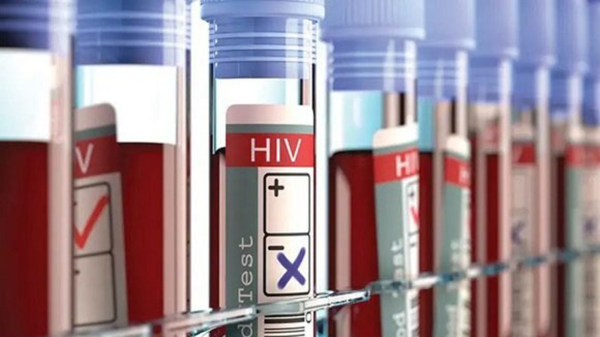 Pacientes con VIH denuncian escasez de antirretrovirales