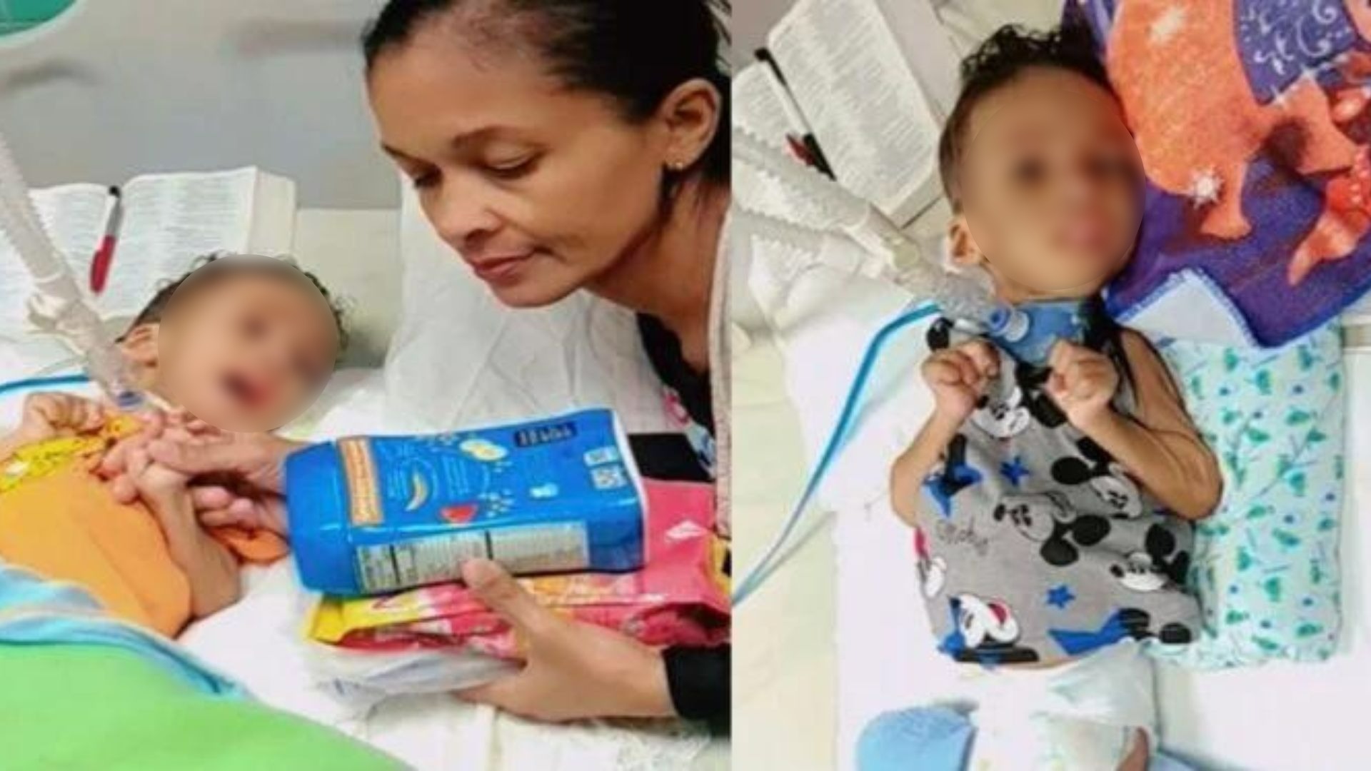Piden ayuda para niño cubano con desnutrición severa