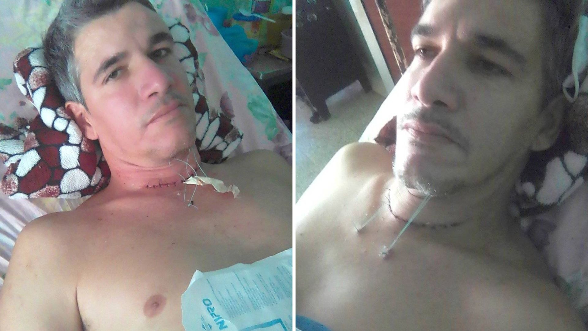 Piden medicamentos para cubano epiléptico: en las farmacias no los hay