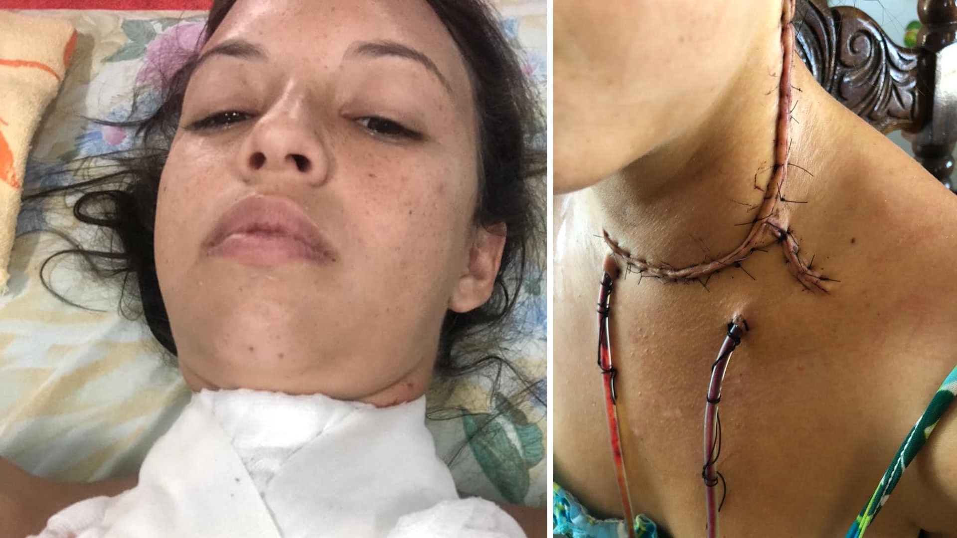 Piden visa humanitaria para adolescente cubana necesitada de tratar su cáncer en EEUU