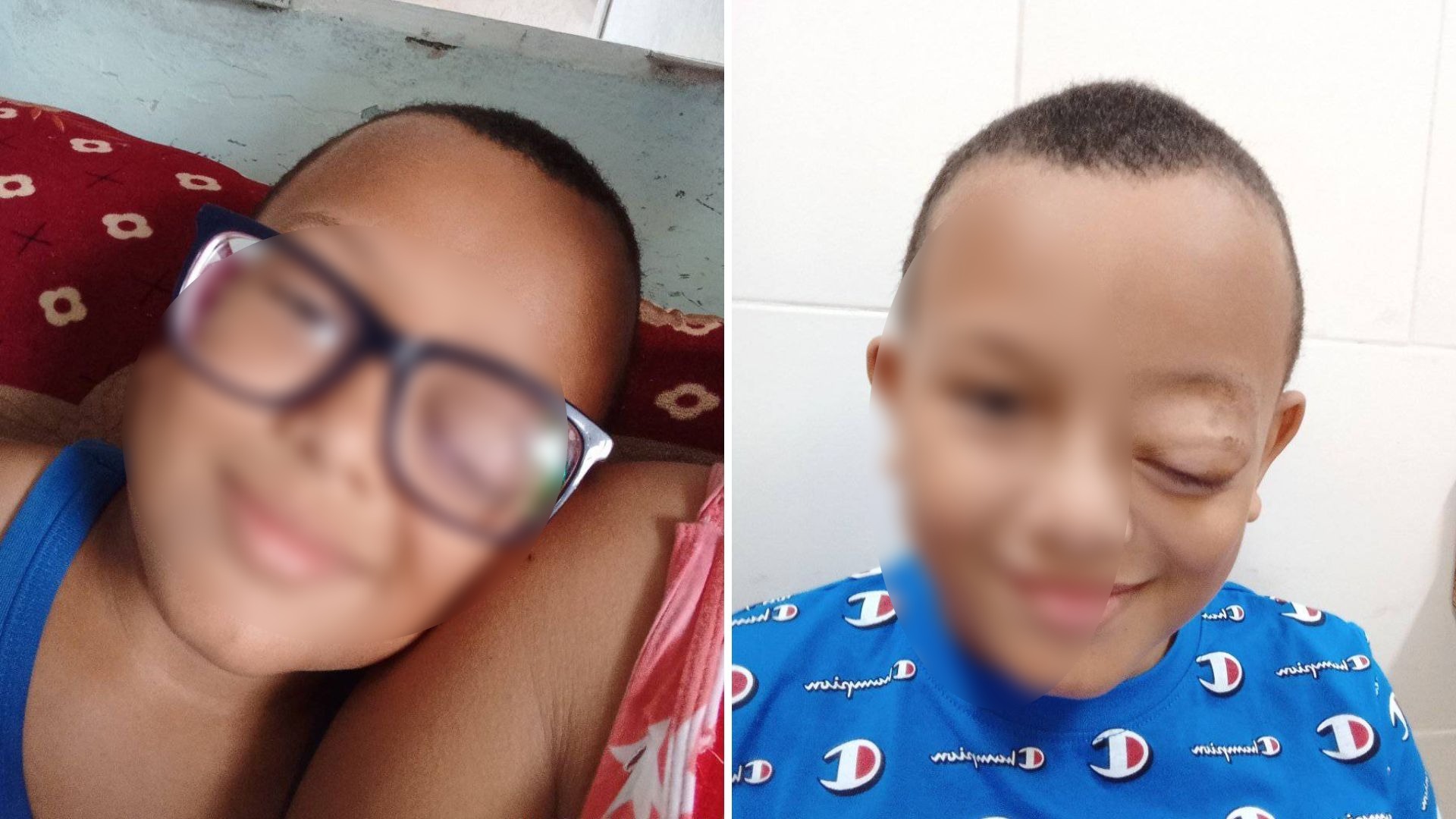 "Pido a gritos una visa humanitaria para mi hijo": niño cubano con tumor en un ojo