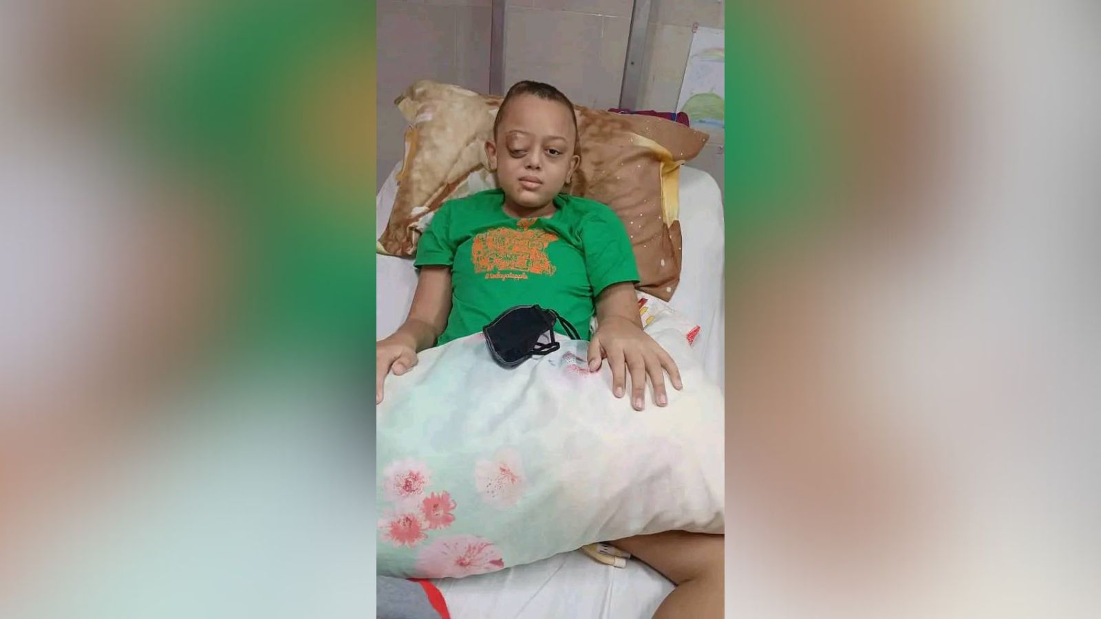 Pierde la visión niño cubano al que el MINSAP le negó carta para recibir tratamiento en el exterior