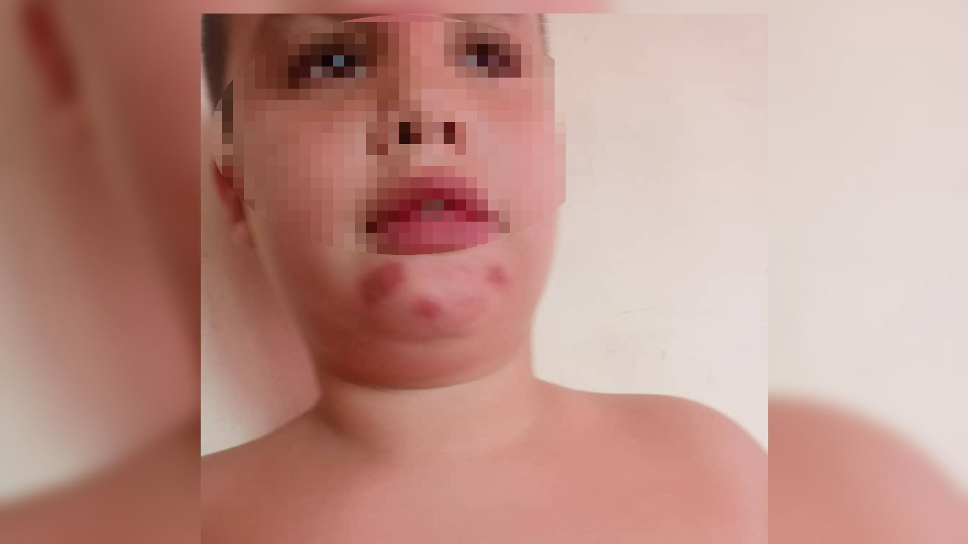 "¿Qué más van a quitar?": niño autista lleva 4 meses sin dieta alimenticia en Cuba