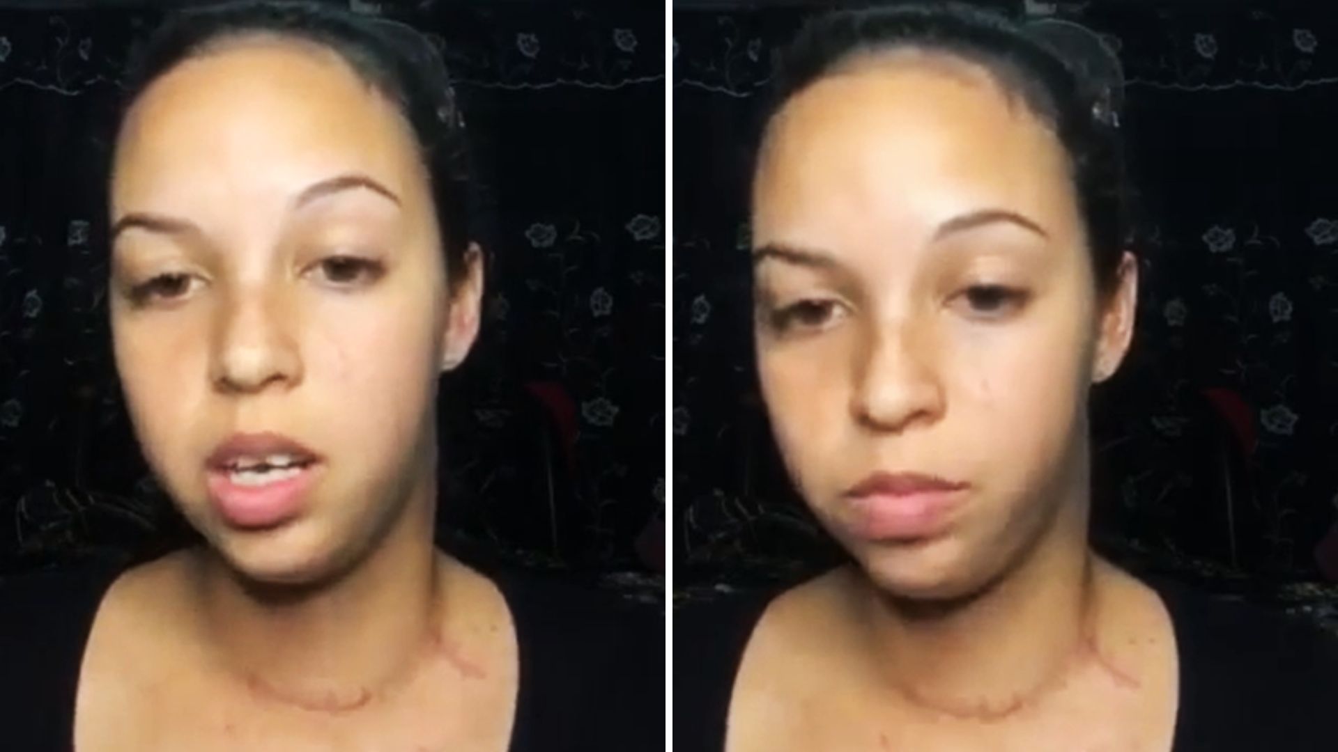 "Quiero seguir con todas mis metas": joven cubana con cáncer agradece apoyo