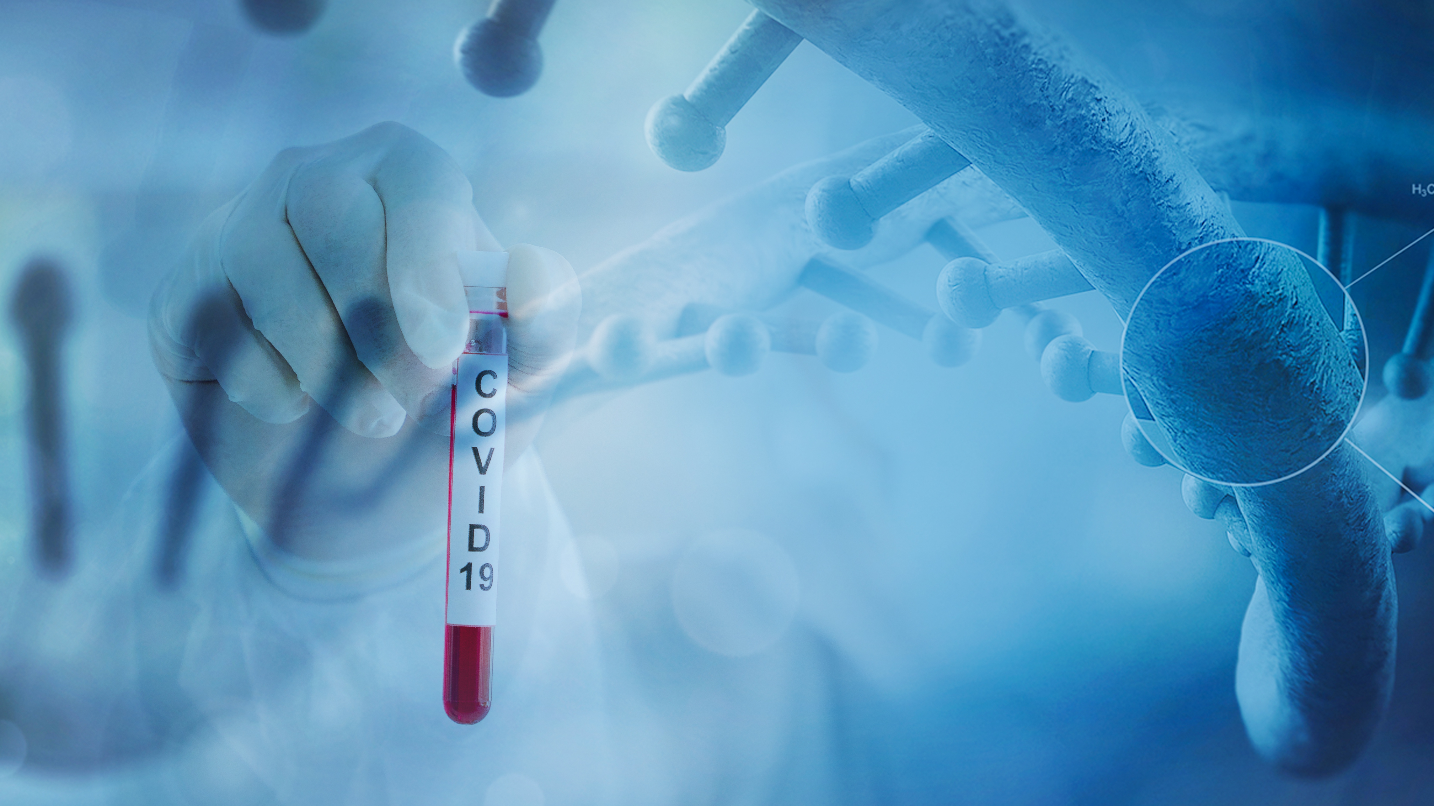 Salud del régimen confirma casos activos de coronavirus en Cuba