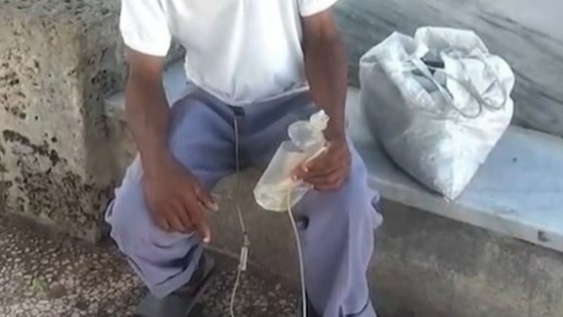 Salud en Cuba: sustituyen bolsas de drenaje de orina por pomos plásticos
