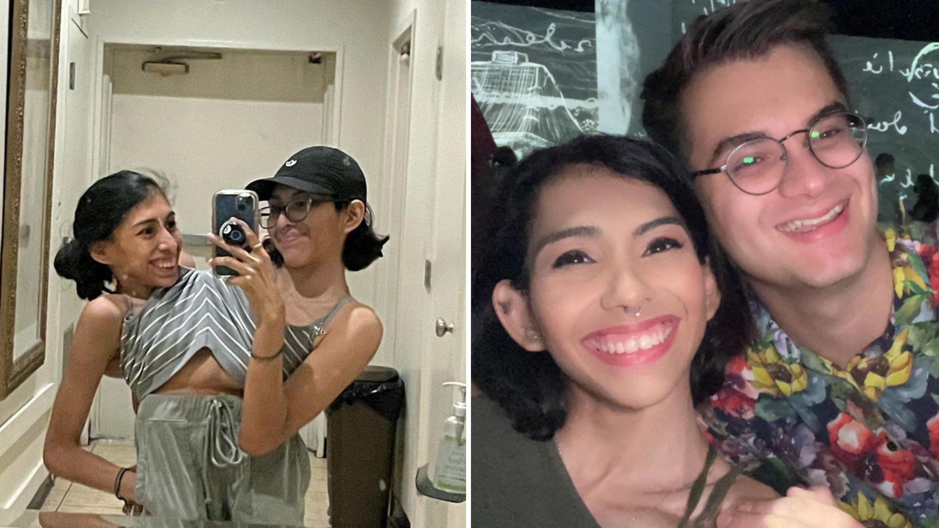Siamesas e influencers: así es como una de ellas mantiene intimidad con su novio