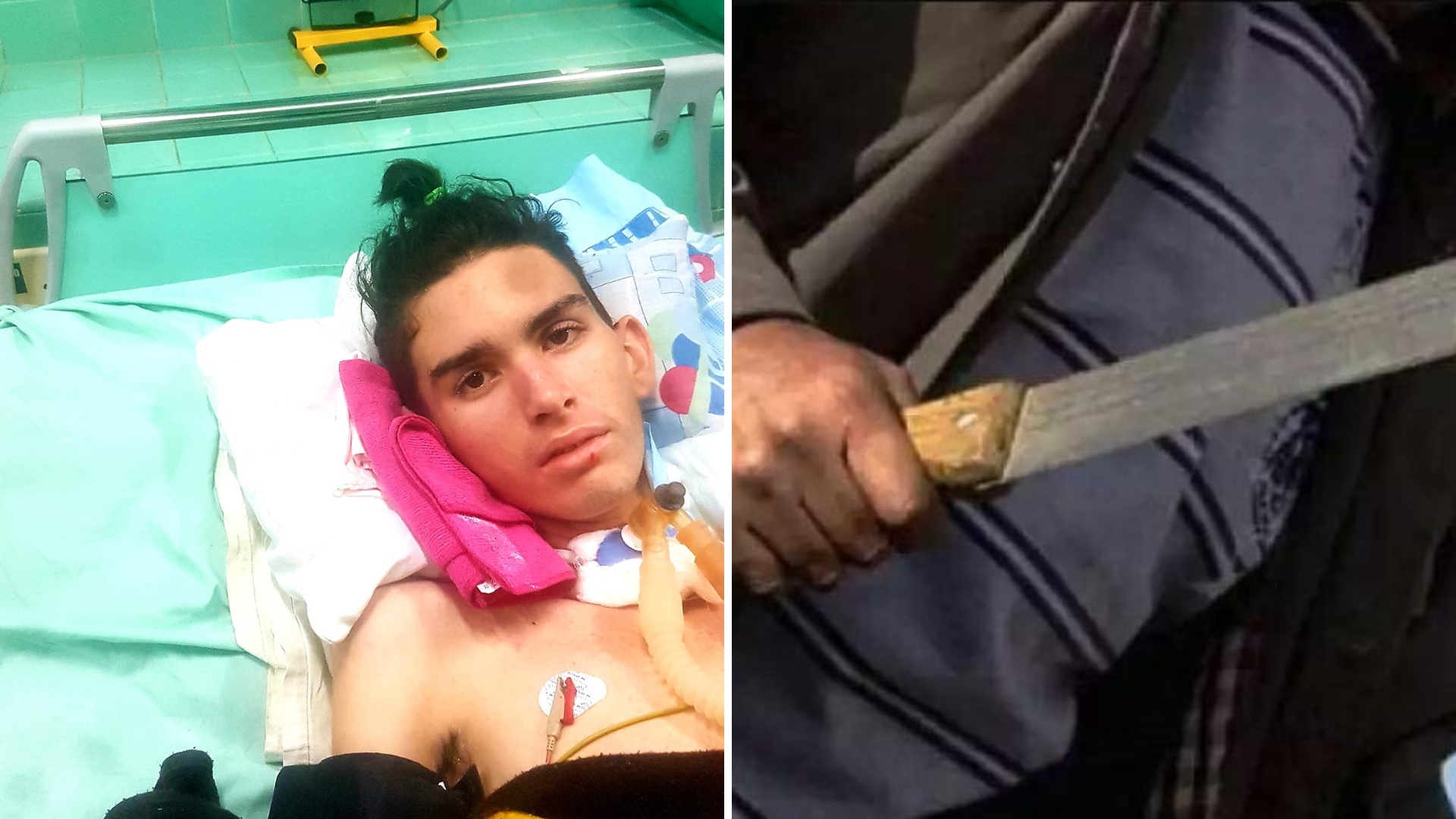 Suspenden juicio a presunto agresor de adolescente macheteado en Holguín 