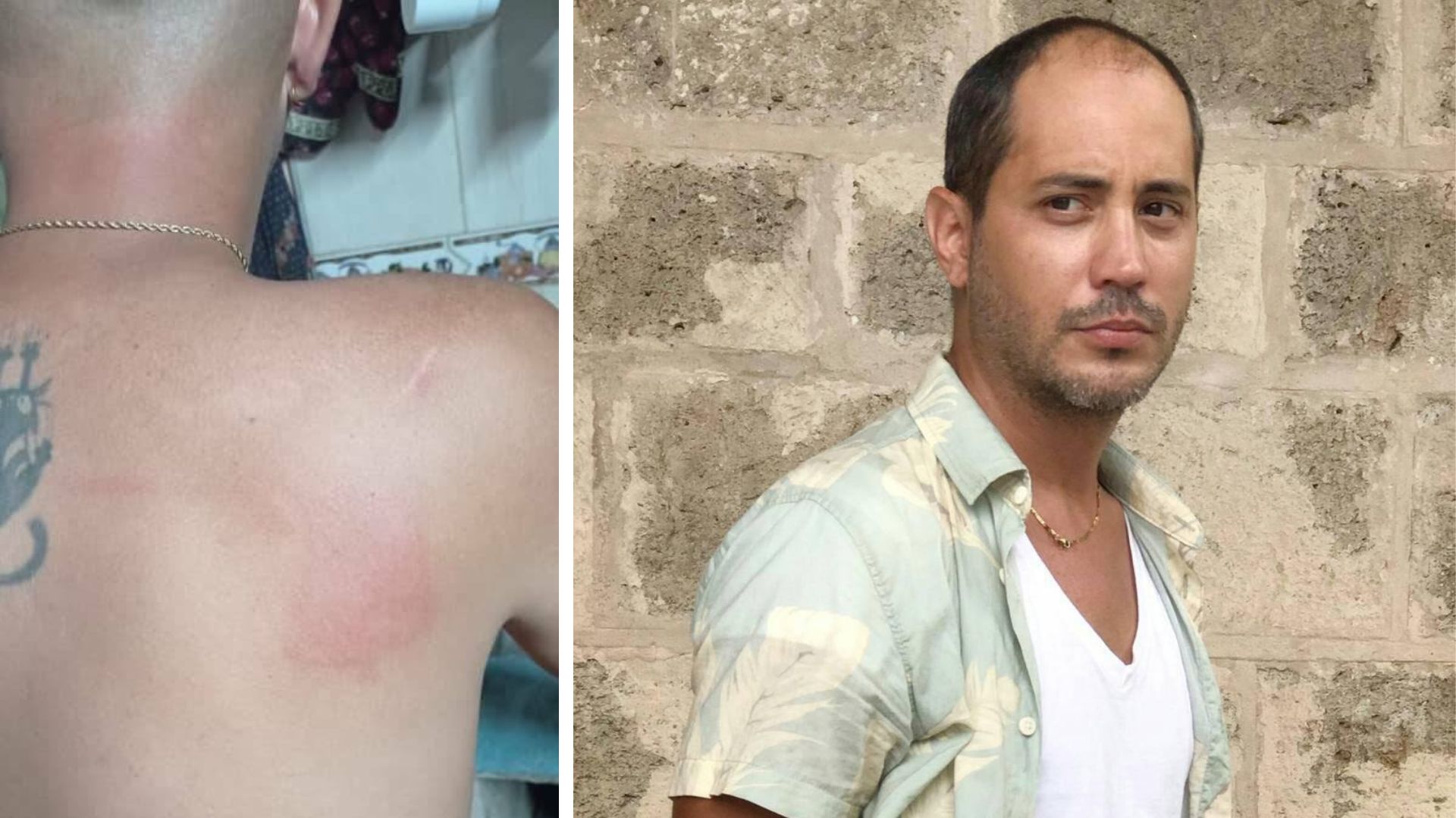 Violento asalto con palo de golf al joven actor Frank Mora en La Habana