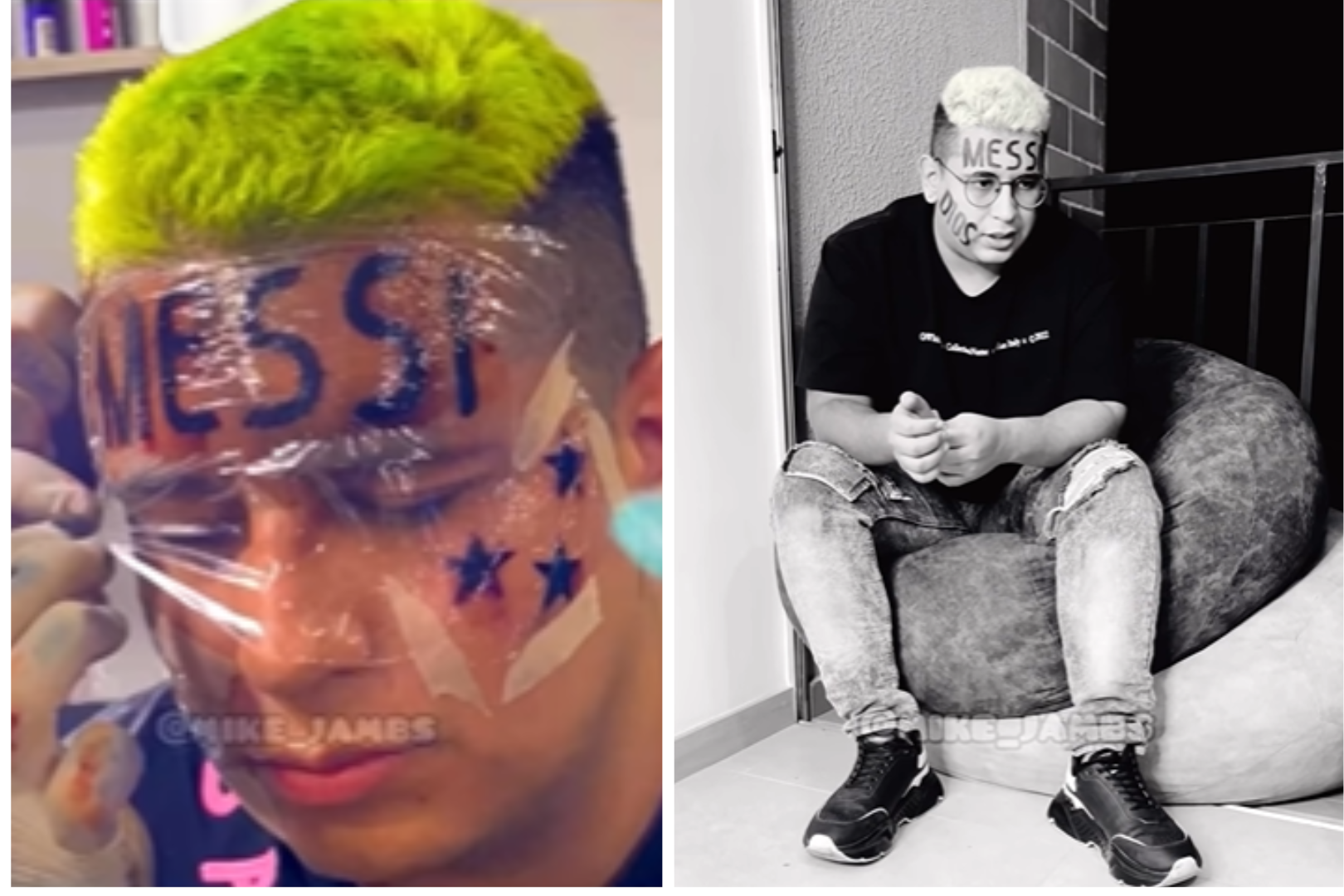 VIRAL: Influencer se tatúa "Messi" en la frente y ahora está arrepentido