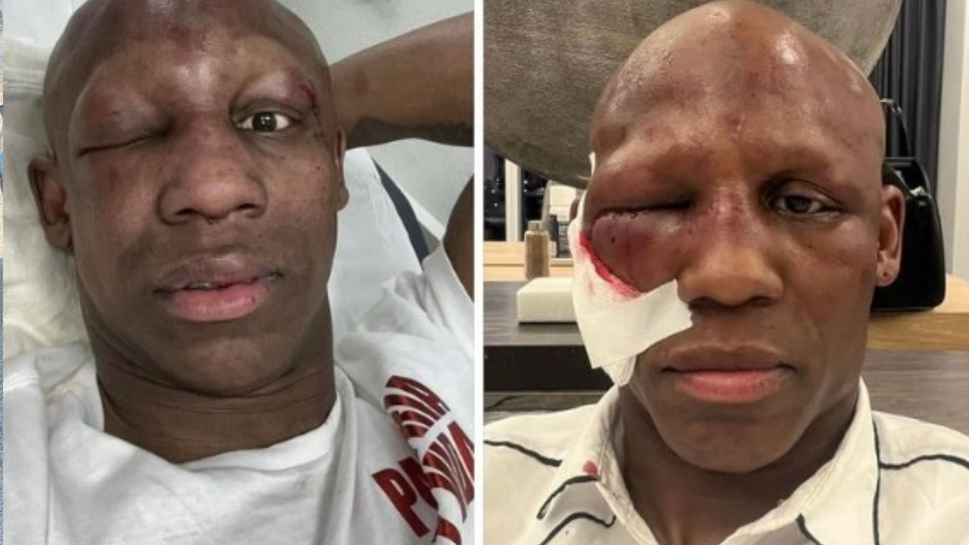 Yordenis Ugás, a pesar de problemas con su ojo, advierte: “Nunca te rindas” 